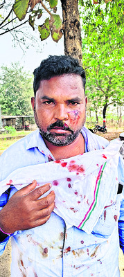 కత్తితో దాడి..  ఒకరికి తీవ్రగాయాలు 
2