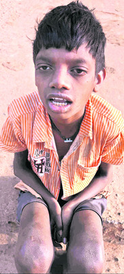 దివ్యాంగ పింఛనుకు నోచుకోని అభాగ్యులు2