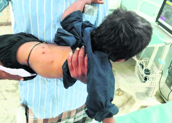 వాహనం ఢీకొని జింక మృతి2