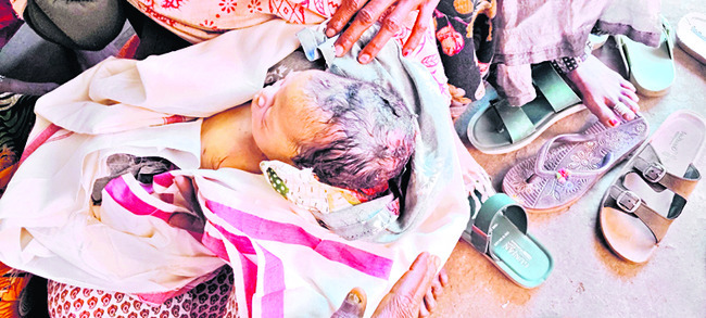 గర్భంలోనే శిశువు మృతి1