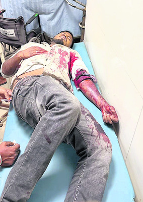 మహిళ కడుపులోంచి   ఆరు కిలోల కణితి తొలగింపు1