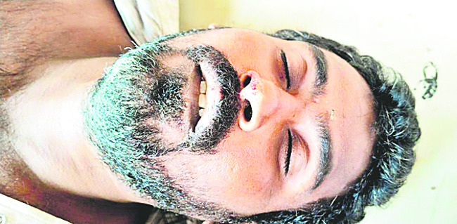 కారు దహనం చేసిన దుండగులు 
3