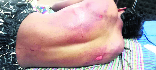 నత్తగుళ్లపాడు వైఎస్సార్‌సీపీ సర్పంచ్‌పై హత్యాయత్నం 3