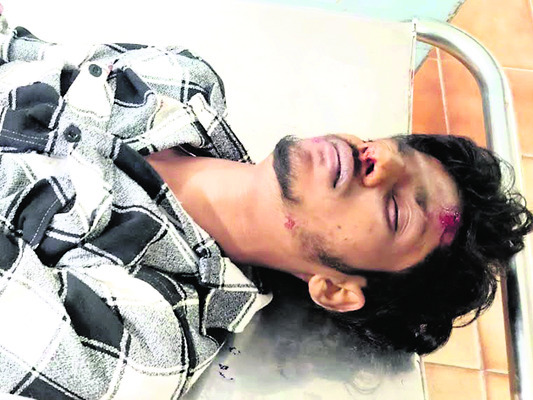 వేర్వేరు ప్రమాదాల్లో ముగ్గురికి తీవ్రగాయాలు1