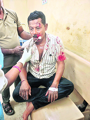 రోడ్డు ప్రమాదంలో వ్యక్తికి గాయాలు 2