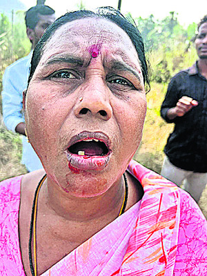 ఇసుక ట్రాక్టర్‌ను ఢీకొన్న ఆర్టీసీ బస్సు 2