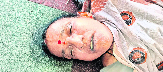 నర్సింగ్‌ కాలేజీలో ఫుడ్‌ పాయిజన్‌! 1