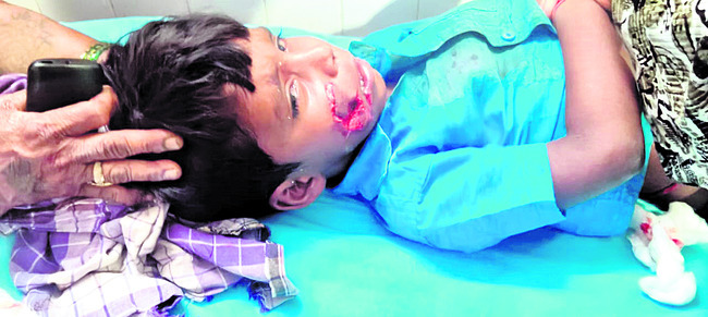 కుక్కకాటుతో బాలుడికి తీవ్ర గాయాలు 1