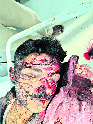 లారీని ఢీకొన్న కారు 2