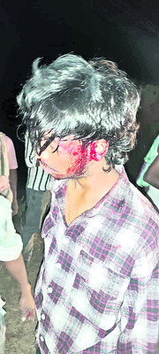 రోడ్డు ప్రమాదంలో నలుగురికి తీవ్ర గాయాలు3