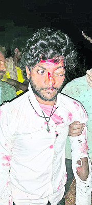 రోడ్డు ప్రమాదంలో నలుగురికి తీవ్ర గాయాలు1