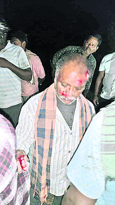 రోడ్డు ప్రమాదంలో నలుగురికి తీవ్ర గాయాలు2