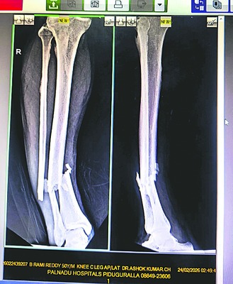పచ్చమూకల పైశాచికం 2