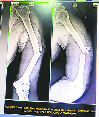 పచ్చమూకల పైశాచికం 1