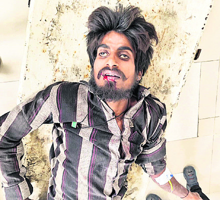 రోడ్డు ప్రమాదంలో వ్యక్తి మృతి3