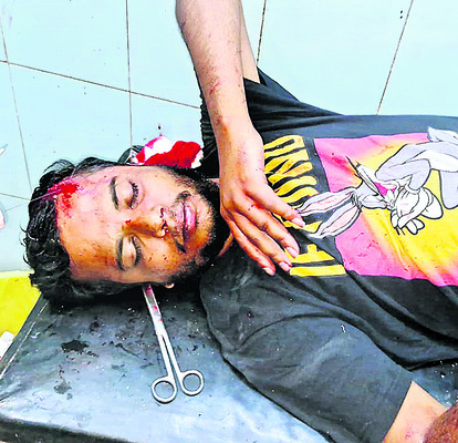 ఇరువర్గాల ఘర్షణ: ఇద్దరికి గాయాలు 1