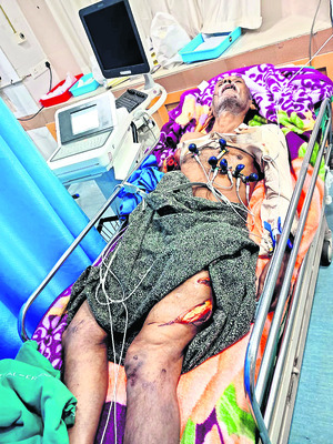 తలశిల రఘురామ్‌కు ప్రసన్న పరామర్శ4