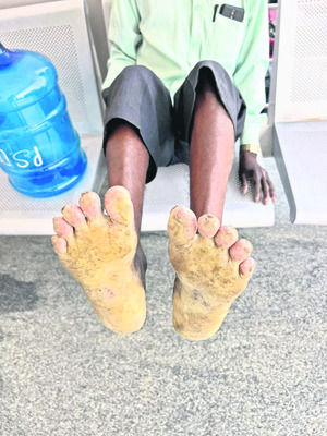 రేర్‌ డిసీజెస్‌.. బీ అలర్ట్‌! 3