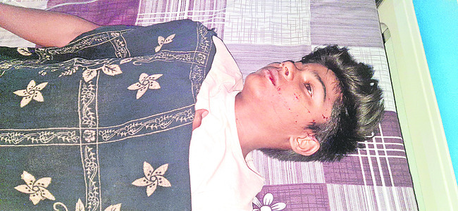 తినేందుకు వెళ్తుంటే.. మృత్యువు దిగమింగింది!  2