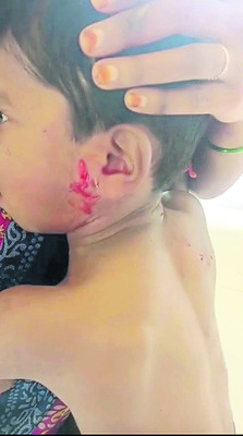 తాండూర్‌లో శునకాల బీభత్సం1