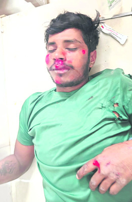 కేబుల్‌ వైర్లు చోరీ2