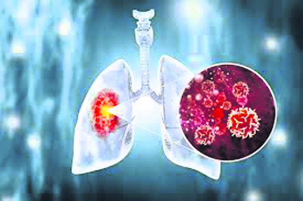 సందర్భం:3