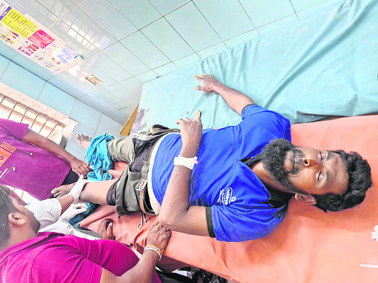 కటర్‌ కాలిమీద పడి వెల్డర్‌కు తీవ్రగాయాలు  2