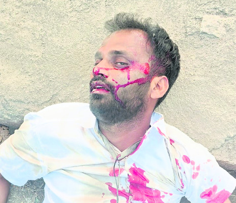 కటర్‌ కాలిమీద పడి వెల్డర్‌కు తీవ్రగాయాలు  1