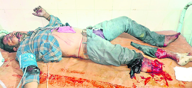 వేర్వేరు ప్రమాదాల్లో నలుగురికి గాయాలు 1