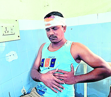 10 మందికి గాయాలు 2