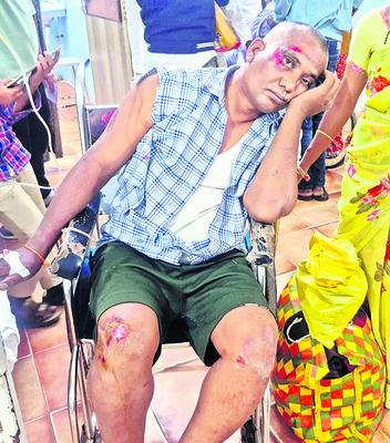 వేర్వేరు ప్రమాదాల్లో 9 మందికి గాయాలు 1