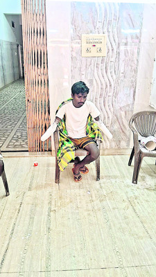 కృత్రిమ అవయవాల శిబిరం5