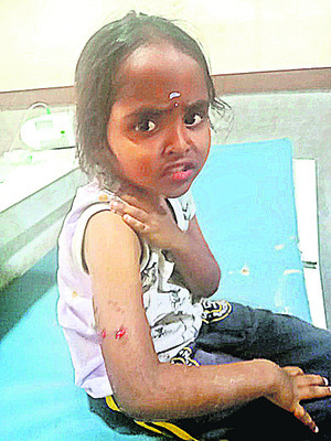 పిచ్చి కుక్క దాడిలో ముగ్గురికి గాయాలు1