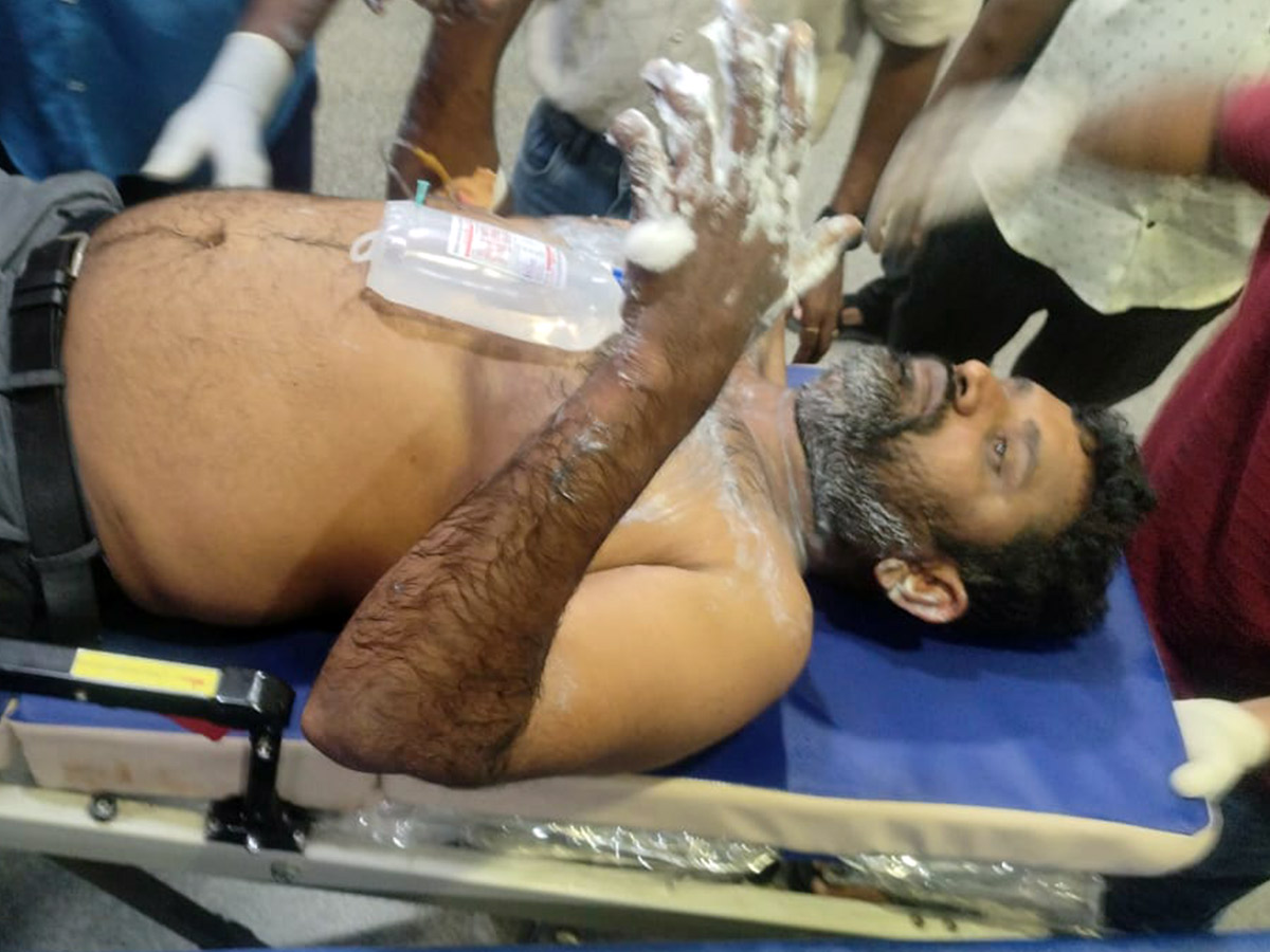 Massive Fire at Visakhapatnam Steel Plant Photos5
