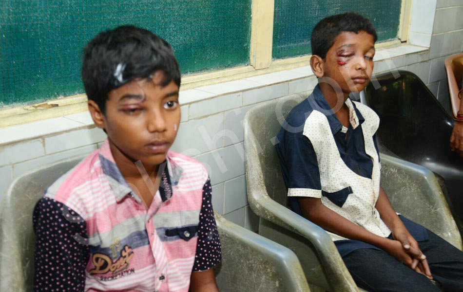 Diwali Eye Accidents in Hyderabad - Sakshi