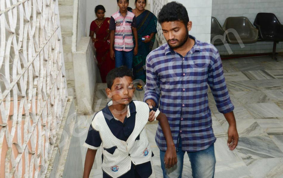 Diwali Eye Accidents in Hyderabad - Sakshi