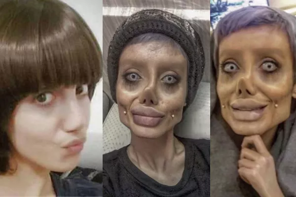 Iranian Girl looks alike Zombie After 50 Surgeries  - Sakshi