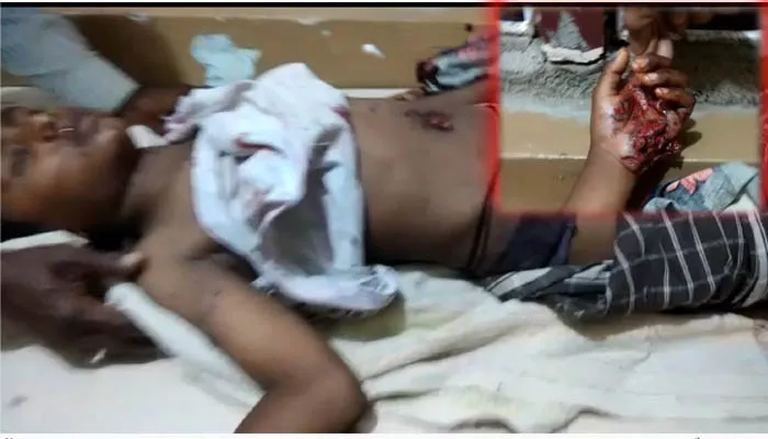 remote car blast..boy injured - Sakshi
