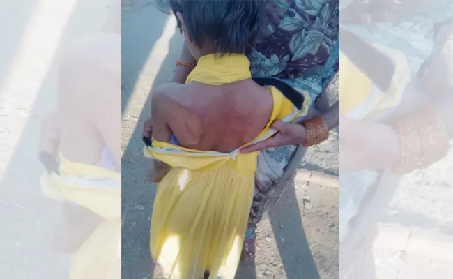 gurukul staff beat tribal student in achampet - Sakshi