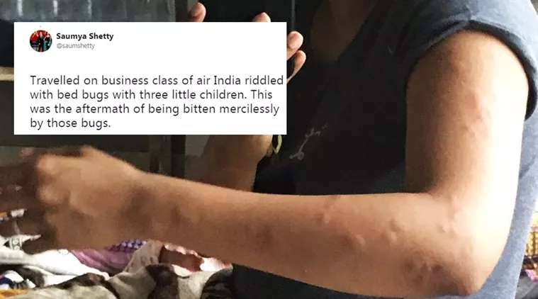 Air India Offers Waiver Not Refund To Traveller After Picture Of Bed Bug Bites - Sakshi