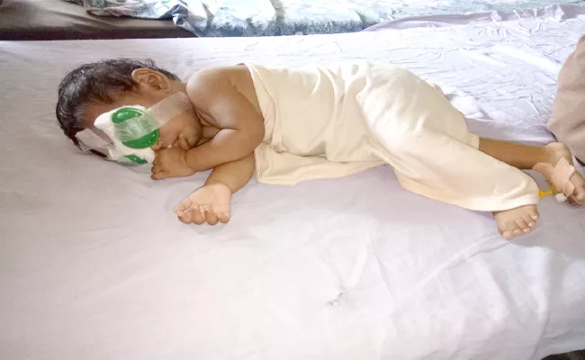 Glaucoma Surgery For Nine Months Baby In Visakhapatnam - Sakshi