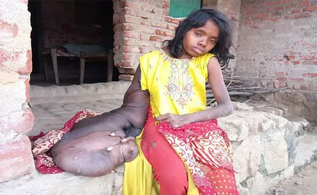 Strange Disease To Orissa Tribal Girl - Sakshi
