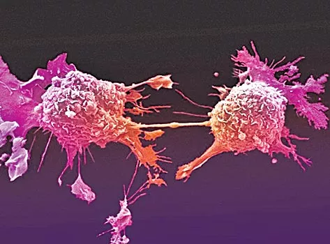 Cancer cells matash with hair gene - Sakshi