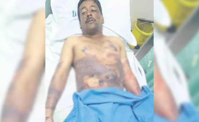 Wife Heat Oil Attack on Husband In Hyderabad - Sakshi