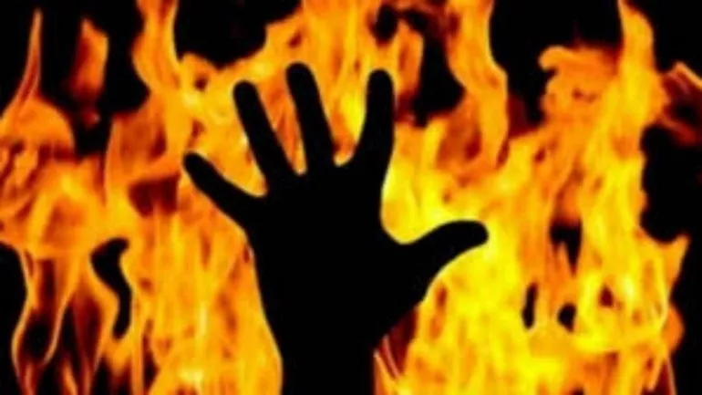 Muslim Boy Set On Fire For Not Chanting Jai Shri Ram - Sakshi