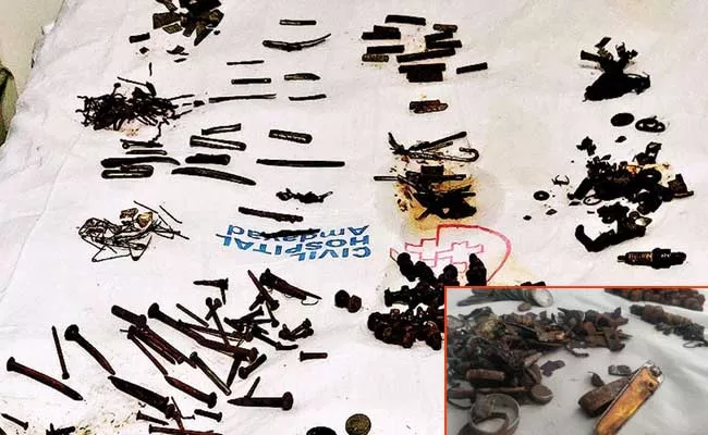 Doctors Find 452 Metal Objects From A Man Stomach In Ahmedabad - Sakshi
