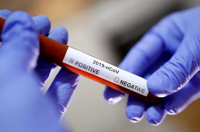 Supreme Court Says Free Coronavirus Testing Only For Poor   - Sakshi