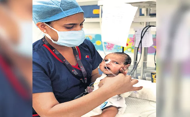Rare Heart Surgery For Three Days Baby in Rainbow Hospital Hyderabad - Sakshi