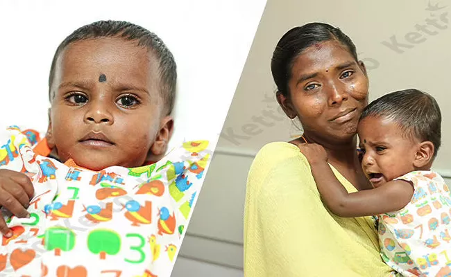 My Baby Is Suffering From Heart Disease Please Help Me And Save Him - Sakshi