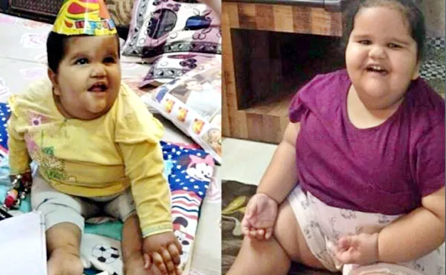  Bariatric surgery on two year-old weighing 45 kg - Sakshi